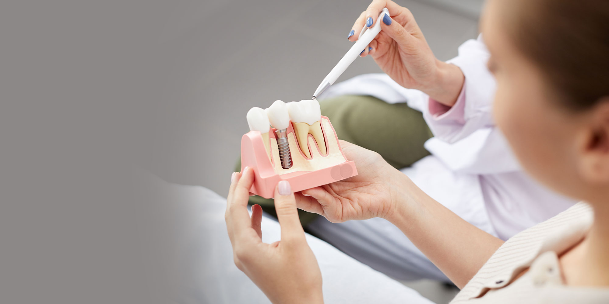 dentist showing patient options for dental implants