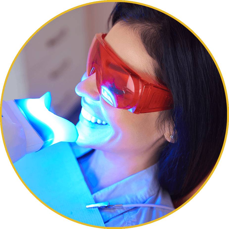 professional teeth whitening